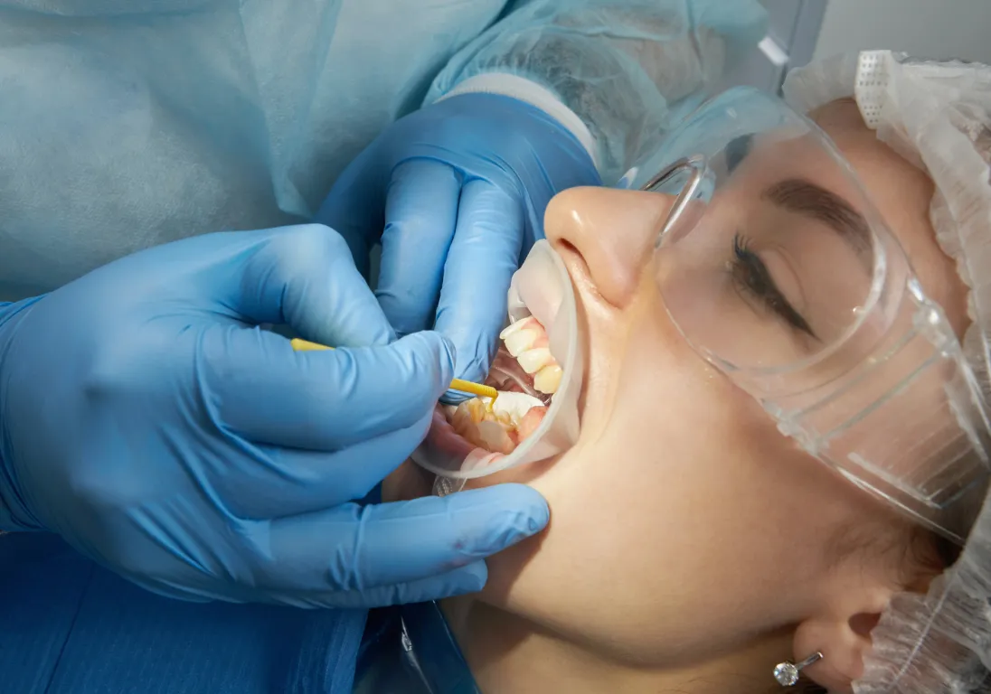 img strong caps for lasting repair 2x